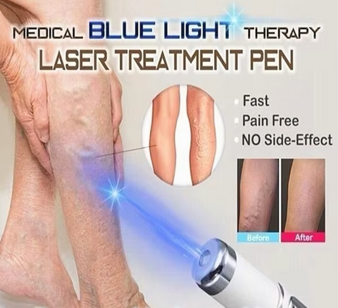 Máquina Portátil de Remoção de Rugas - Caneta Laser Acne