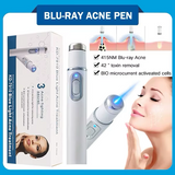 Máquina Portátil de Remoção de Rugas - Caneta Laser Acne